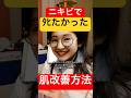 本当に毎日が地獄だった。学生時代のニキビを全部消した方法