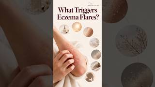 Why Does Eczema Flare Up? Skin Triggers Explained