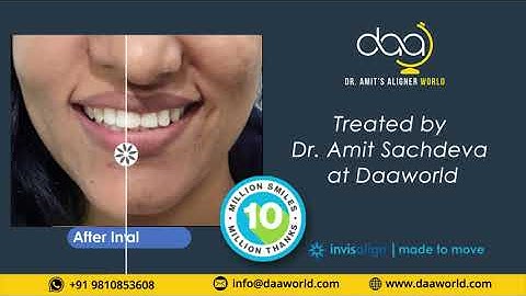 Treated by Dr Amit Sachdeva at Daaworld.