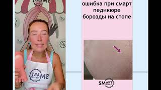 : SMART  -  