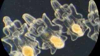 イトマキヒトデ幼生