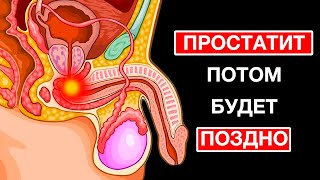 Всего 15 Минут И Простатит Уйдет Навечно! Начни Делать Это... Как Предотвратить Простатит?