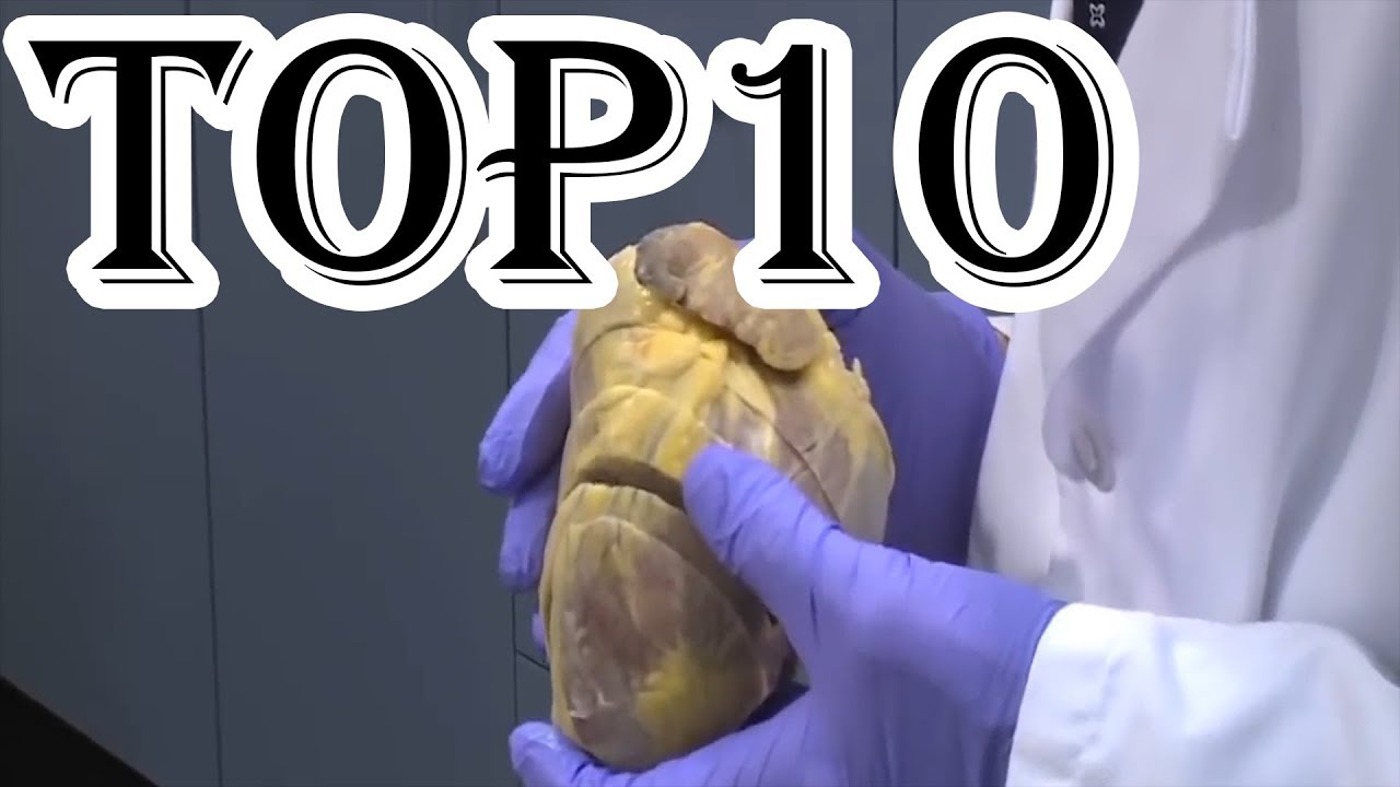 Top 10 Most Expensive Medical Treatments YouTube