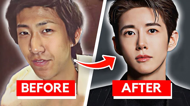 Jaw-Dropping Plastic Surgeries of Korean Actors [Part 3]