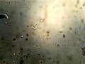 Капля грязной воды под микроскопом (инфузории туфельки, амебы, бактерии, коловратки)