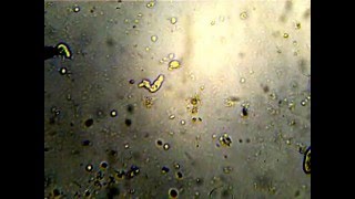 Капля грязной воды под микроскопом (инфузории туфельки, амебы, бактерии, коловратки) Капля грязной воды под микроскопом (инфузории туфельки, амебы, бактерии, коловратки)
