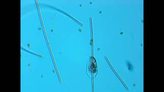 AMOEBA TIME-LAPSE