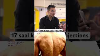 17 saal ki age mein injections - see this - Tarun gill talks