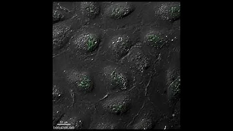 Detection of oxidative stress with CellROX® Green in U2-OS cells