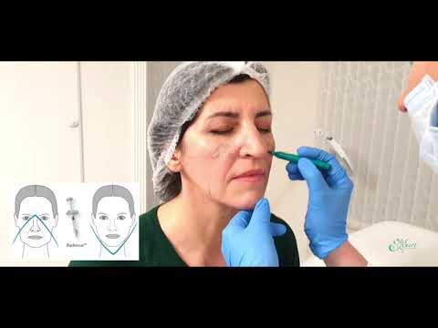 Video: Hidroxiapatita De Calciu - Instrucțiuni, Aplicare în Cosmetologie