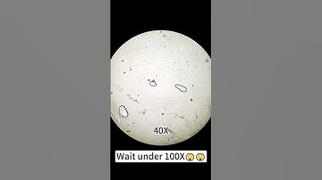 Shrimp magnified 400X is seriously awesome!   #underthemicroscope #microscope #science