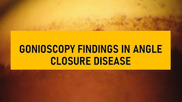 #8 Gonioscopy | GONIOSCOPY IN NARROW ANGLES