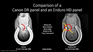 Image Quality in Digital Radiography