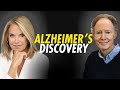 دراسة رائدة حول مرض الزهايمر عليك أن تسمع عنها 