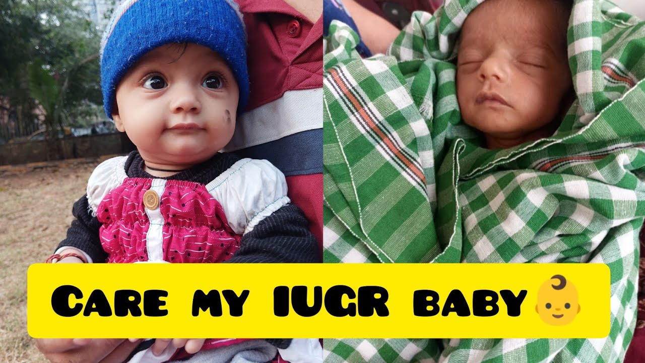 How I Care My IUGR Baby After Birth YouTube how-i-care-my-iugr-baby-after-birth-youtube
