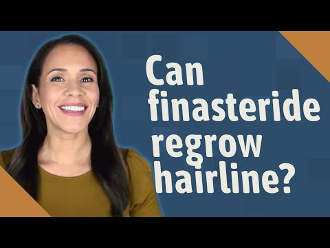Can finasteride regrow hairline?