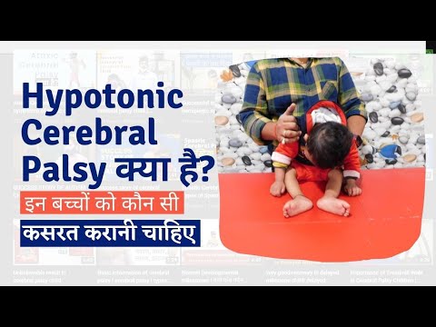 वीडियो: क्या सभी बच्चे झुक कर चलते हैं?