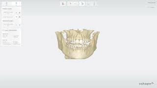 Removing teeth from a surface scan in Implant Studio