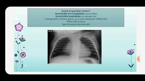 Cosa fare in caso di bronchiolite?