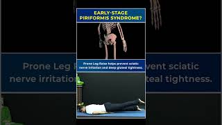 Early-Stage Piriformis Syndrome? Try This Prone Leg Raise #PiriformisSyndrome #asana