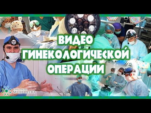 Огромный полип цервикального канала