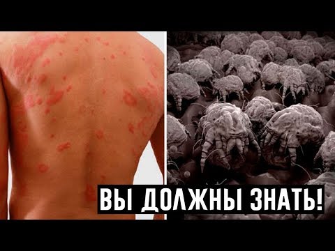 Пылевые клещи в вашей постели причина ваших болезней, убейте их с помощью этого простого решения!