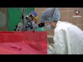 Gastric Lymphoma