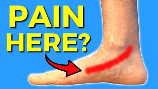 Exam & Treatment for Posterior Tibial Tendon Dysfunction