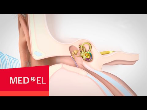 Video about Hearing and How it Works | MED-EL