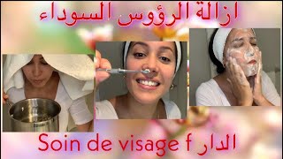 ازالة الرؤوس السوداء وتنظيف عميق للبشرة في المنزل |les points noirs|soin de visage