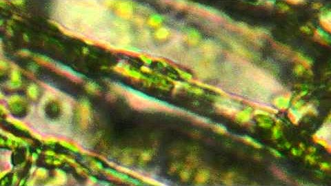 Microscope View of Plant Cells