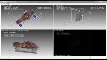 3D Image Registration