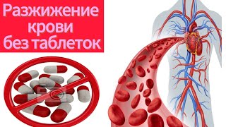 Густая кровь -- 10 простых советов для разжижение крови в домашних условиях.