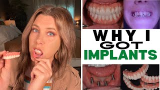 Why did I get implants?