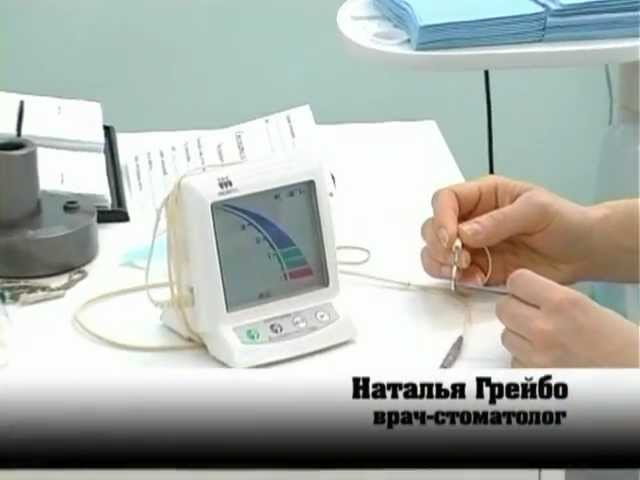 Лечение корневых каналов зубов