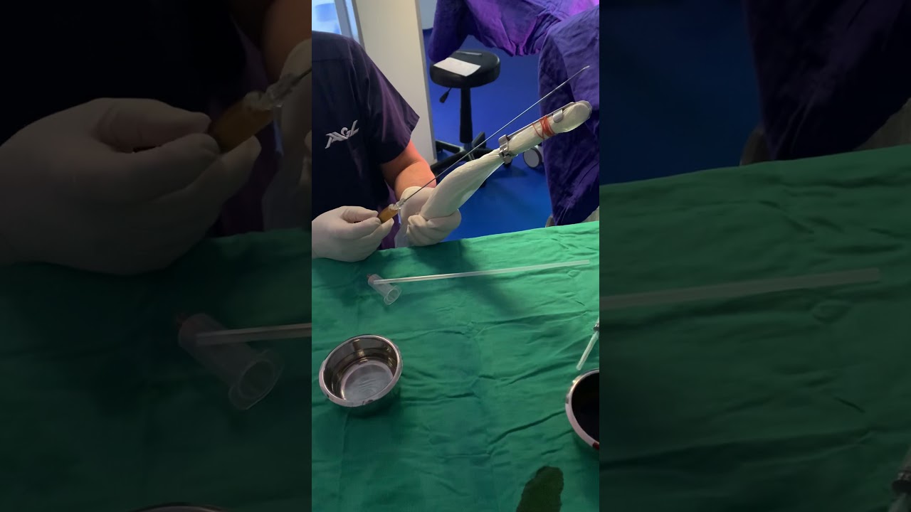 البلازم الغني بصفائح الدموية  في المبيضين PRP INTRA OVARIEN