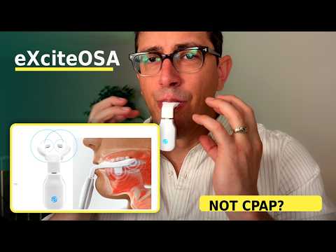 An honest eXciteOSA review covering daytime tongue therapy for snoring, mild sleep apnea, baseline tracking, research, and first impressions.