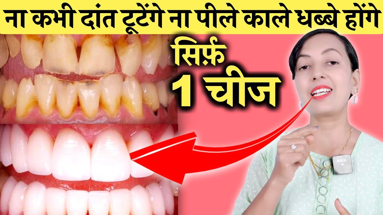 सिर्फ़ 1 चीज ना कभी दांत टूटेंगे ना पीले या काले धब्बे होंगे | Teeth