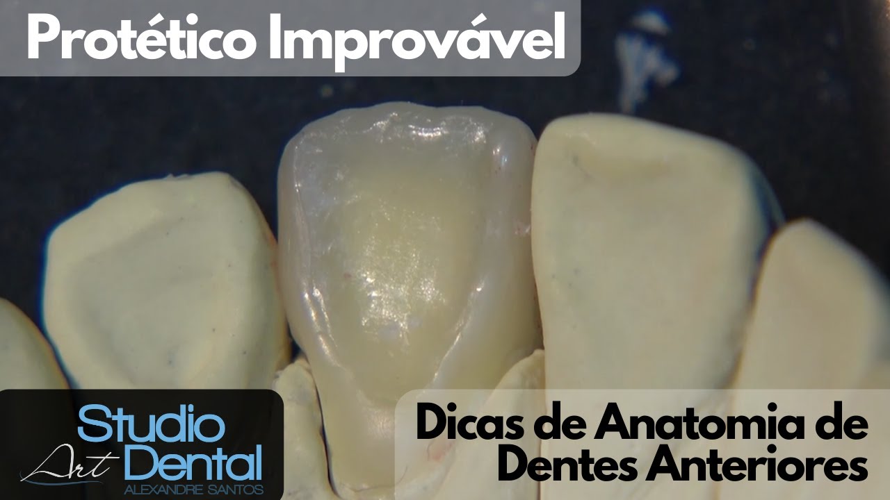 Protético Improvável - Dicas em Anatomia de Dentes Anteriores