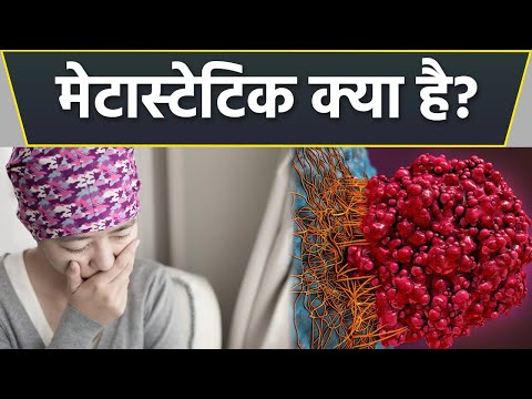 वीडियो: मेटास्टेटिक कैंसर वाले किसी व्यक्ति की आजीवन क्या है?