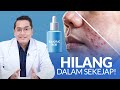 Salep Jerawat Asam Salisilat: Solusi Jitu Atasi Jerawat Bandel