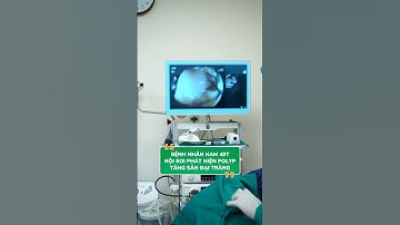 Polyp tăng sản đại tràng