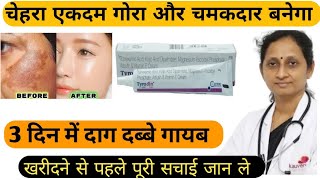 Tyrodin cream review | Tyrodin cream use | 5 दिन में गोरा करगी tyrodin cream | Tyrodin cream hindi