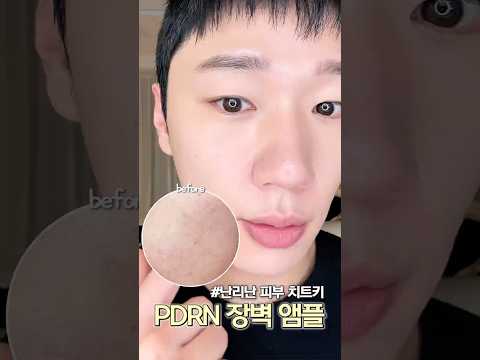 바스라진 피부 싹 살려주는 PDRN 앰플?