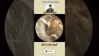Wet & Dry Earwax Compilation