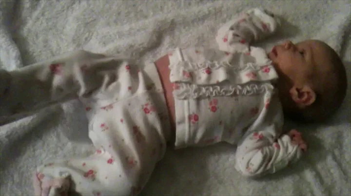 AIMS Evaluation 0 to 3 Months Observation Case 7 1