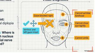 Decoding Facial Colliculus Syndrome (Clinical Case scenario series’s 4)