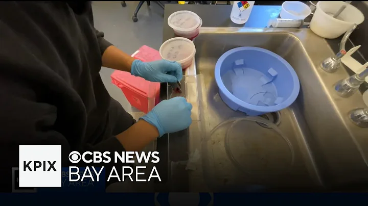 Stanford researchers unveil blood clot treatment breakthrough