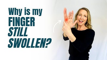 Why is My Finger Still Swollen?