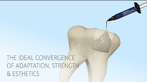 One-Step Bulk Filling - G-ænial™ BULK Injectable